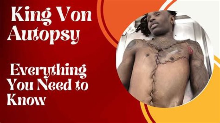 King Von Autopsy Results: A Detailed Examination of His Life and Legacy