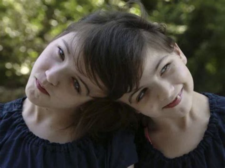 Tatiana and Krista Hogan 2024: A Unique Journey of Twin Sisters